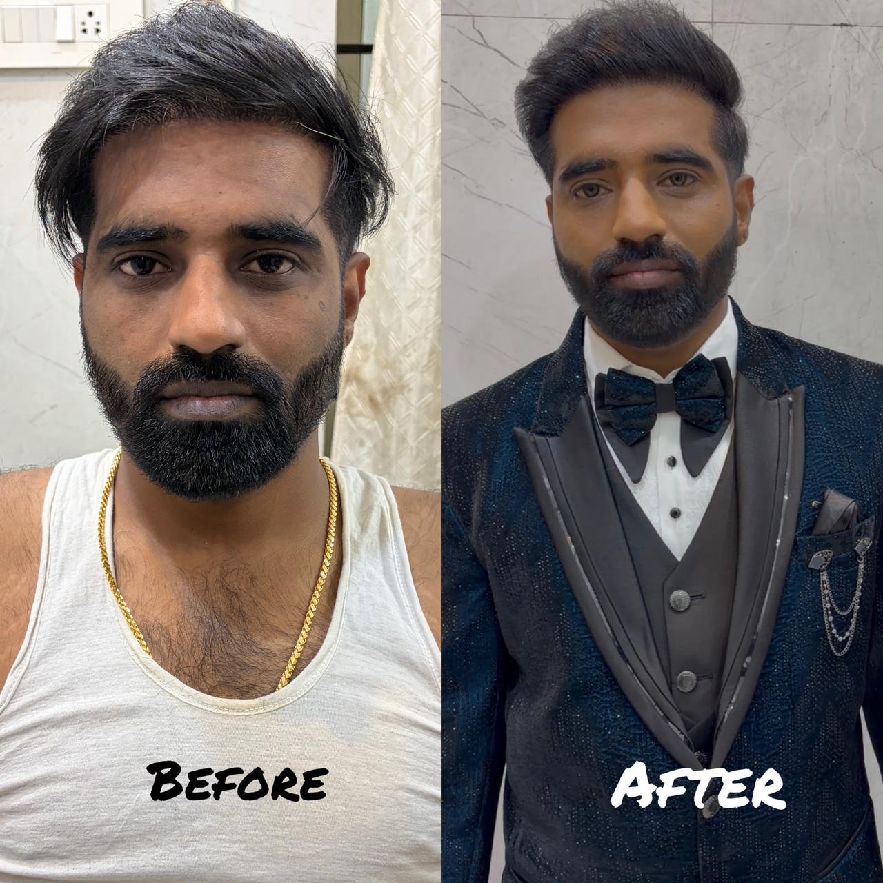 Groom Makeup Before After Chennai